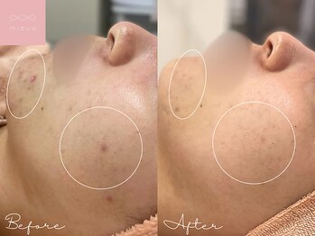 ミュー 名駅店(mieux)/お客様Before/After