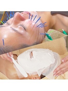 エマ(Ema.)の写真/鍼で筋肉・血流を整えた後、石膏パックで美容成分を使用し浸透力UP◎内と外からのＷアタックで美しく♪