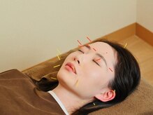 ホープ鍼灸整骨院