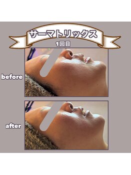 ビーマジック(美magic)/サーマトリックス