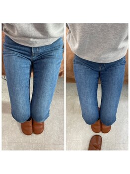 はるかぜ療術院/内もも痩せ！