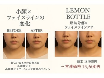 ブリリアントスマイル