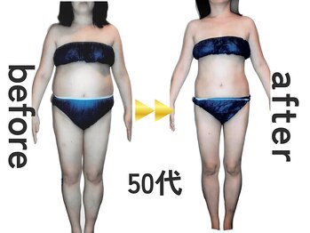 ジュリアン(Julien)/【お客様結果写真】[麹町/痩身]