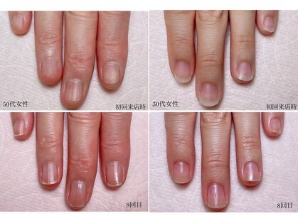 クリコネイル(kuriko nail)の写真
