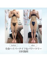 エスプレッソ(espresso,)/脂肪が取れると華奢に♪