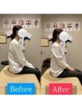 ナオル整体 宮崎院(NAORU整体)/30代女性施術事例【猫背改善】