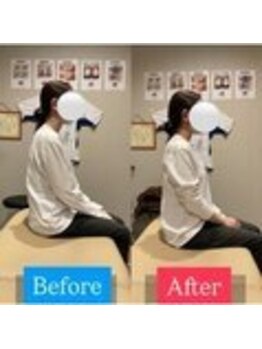 ナオル整体 宮崎院(NAORU整体)/30代女性施術事例【猫背改善】