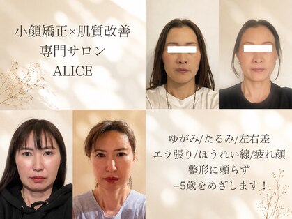 アリス(ALICE)の写真