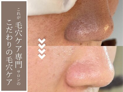 ベルエドゥース(Belle et Douce)の写真
