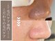ベルエドゥース(Belle et Douce)の写真