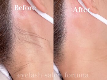 フォルトゥーナ(fortuna)/オプションmenu～襟足ワックス～