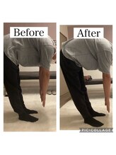 ワン ストレッチ(ONE stretch)/30代男性before・after