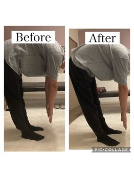 ワン ストレッチ(ONE stretch)/30代男性before・after