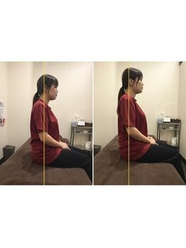 池袋東口整体院/施術後の効果を一緒に確認♪