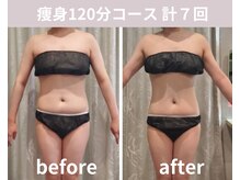 フェリシア(Felicia)/【痩身120分】計7回の結果