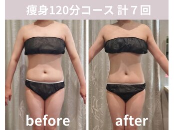 フェリシア(Felicia)/【痩身120分】計7回の結果