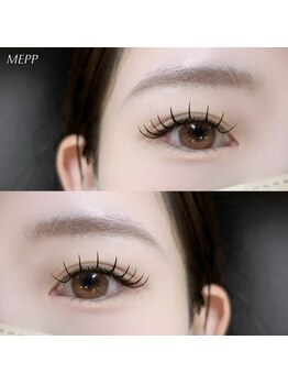 ミイプ(MEPP)/つねいし担当＊フラットラッシュ