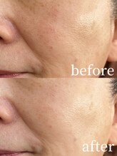 コスメティック雅/【透明感アップ】