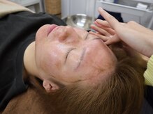 レン(Ren)/ハーブピーリング〈肌質改善〉