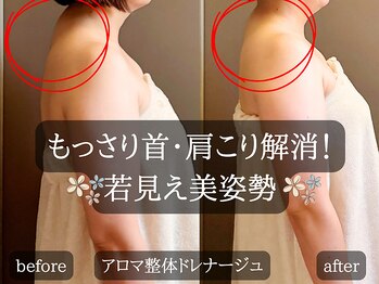 ミトラ(MITRA)/もっさり首＆肩こり解消☆