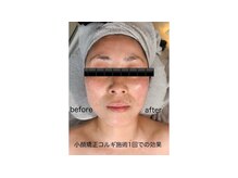 アジュ(Aju)の雰囲気（小顔コルギ矯正６０分のオールハンドマッサージ）