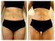 愛 まぁるの写真/｢年末年始は楽しみたい♪けど毎年、年明けに体重が増えて慌ててしまう｣大人女性へ☆無理なダイエットは卒業