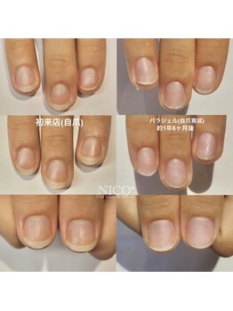 ニコプラス(NICO+)/自爪育成中
