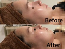整顔整頭/小顔ケア