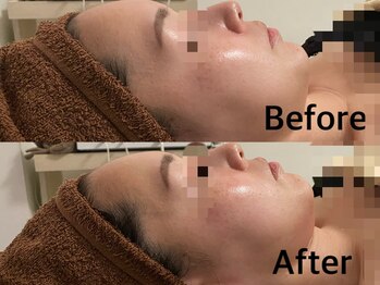 整顔整頭/小顔ケア