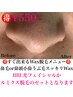 【鼻毛ワックス脱毛】☆光脱毛かBBLとのset で割引き☆正規価格¥2,200→¥550