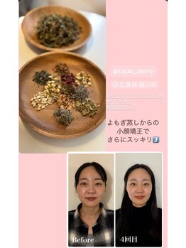 ピオニー(Peony)/Before & After