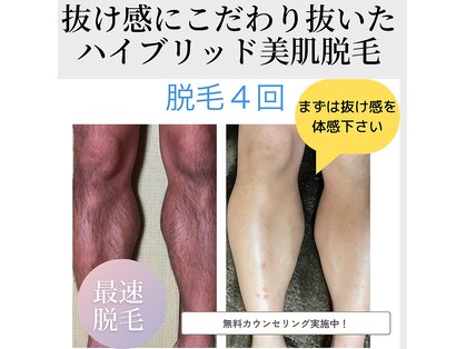 ルモナ(Rumona)の写真