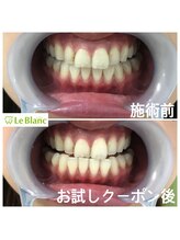 ルブラン 奈良店(Le Blanc)/お子様連れも大歓迎！