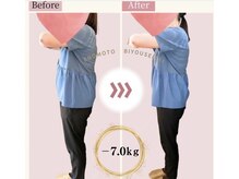 えのもと美容整体院/50代女性