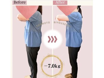 えのもと美容整体院/50代女性