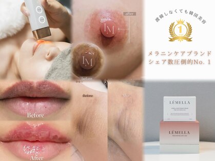 ルナベル(Luna Bell)の写真