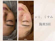 フラーブ(Flourb)の雰囲気(『ハーブピーリング×小顔マッサージ』セットになって血行促進◎)