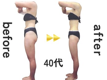 ジュリアン(Julien)/【お客様結果写真】[麹町/痩身]