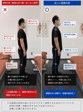 カラダファクトリー 関目高殿店/【城東区整体】反り腰ってなに？