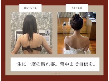 ベベティー(BEBETIE)の写真/【最短の結果出しにこだわる方必見！】大切な結婚式。自分史上最高のドレス姿を目指しませんか？