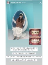 ホワイトニングビューティー 名古屋栄店(WHITENING BEAUTY)/セルフホワイトニング