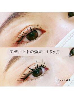 オリエンス(oriens)/“ラッシュアディクト“