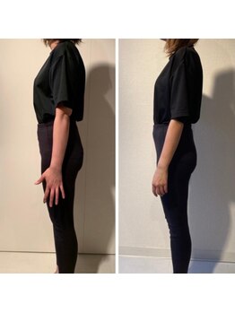 ザ エスアップ 博多店(THE S-UP)/施術前後写真