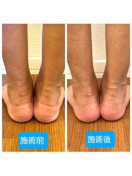 コハク(kohaku)/ビフォーアフター