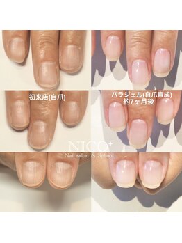ニコプラス(NICO+)/自爪育成中