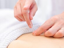 鍼灸イズンの雰囲気（細い鍼で、身体に優しくアプローチします。）