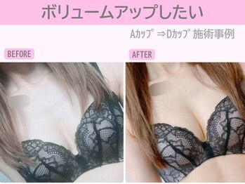 ぷるるんエステ/バストケア/バストアップ/育乳