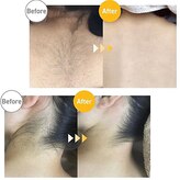 アルゴ 春日那珂川店(ALGO)