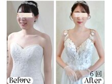 蒼(so)の雰囲気（ブライダルエステ整体。肩幅/巻き肩/猫背/フォト&ブログチェック）