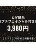 【BLACK FRIDAY】ヒゲ脱毛(プチフェイシャル付き)14,300円→3,980円